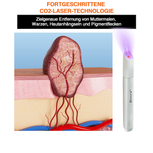 Bivora®✨ VelvetSkin+ – CO₂ lézeres toll a 🟤 anyajegyek, 🦠 szemölcsök, 🔘 pigmentfoltok és egyéb bőrhibák eltávolítására 🩹