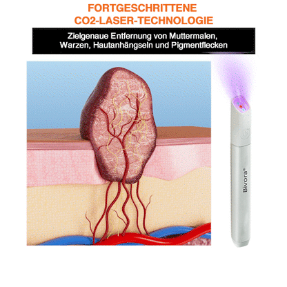 Bivora®✨ VelvetSkin+ – CO₂ lézeres toll a 🟤 anyajegyek, 🦠 szemölcsök, 🔘 pigmentfoltok és egyéb bőrhibák eltávolítására 🩹