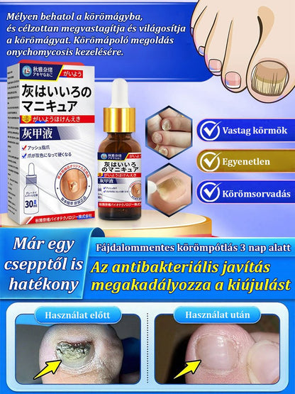 【3 nap fájdalommentes új köröm】Vastagító és fényesítő ápoló folyadék gombás körömre