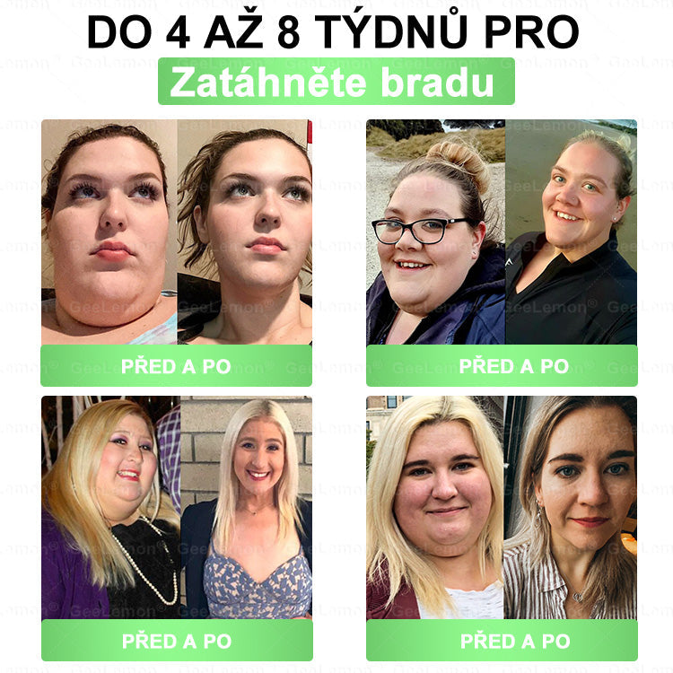 💥Doporučeno Fakultní nemocnicí Motol · Oficiální prodejna BENU | 🎁 𝐆𝐞𝑒𝑙𝑒𝐦𝐨𝐧® Glum𝐚𝐬𝐞tide 8 v 1 – Zeštíhlující nano mikrojihlový náplast 🇨🇿 Jen 1× denně ✅ Viditelné změny za 7 dní – na obezitu, kardiovaskulární zdraví, diabetes a kloubní problémy