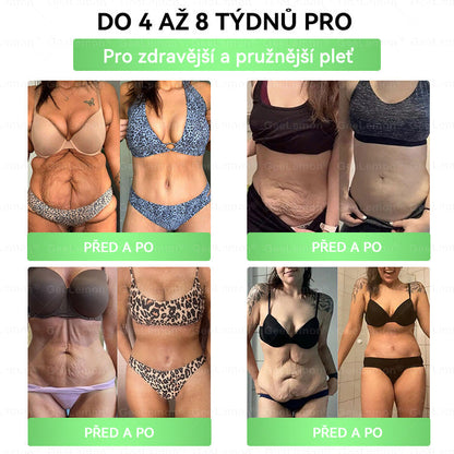 💥Doporučeno Fakultní nemocnicí Motol · Oficiální prodejna BENU | 🎁 𝐆𝐞𝑒𝑙𝑒𝐦𝐨𝐧® Glum𝐚𝐬𝐞tide 8 v 1 – Zeštíhlující nano mikrojihlový náplast 🇨🇿 Jen 1× denně ✅ Viditelné změny za 7 dní – na obezitu, kardiovaskulární zdraví, diabetes a kloubní problémy