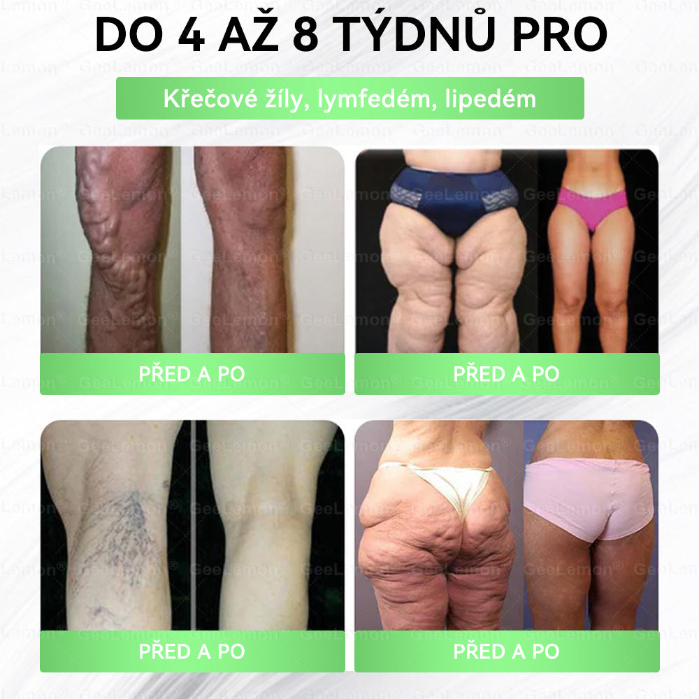 💥Doporučeno Fakultní nemocnicí Motol · Oficiální prodejna BENU | 🎁 𝐆𝐞𝑒𝑙𝑒𝐦𝐨𝐧® Glum𝐚𝐬𝐞tide 8 v 1 – Zeštíhlující nano mikrojihlový náplast 🇨🇿 Jen 1× denně ✅ Viditelné změny za 7 dní – na obezitu, kardiovaskulární zdraví, diabetes a kloubní problémy