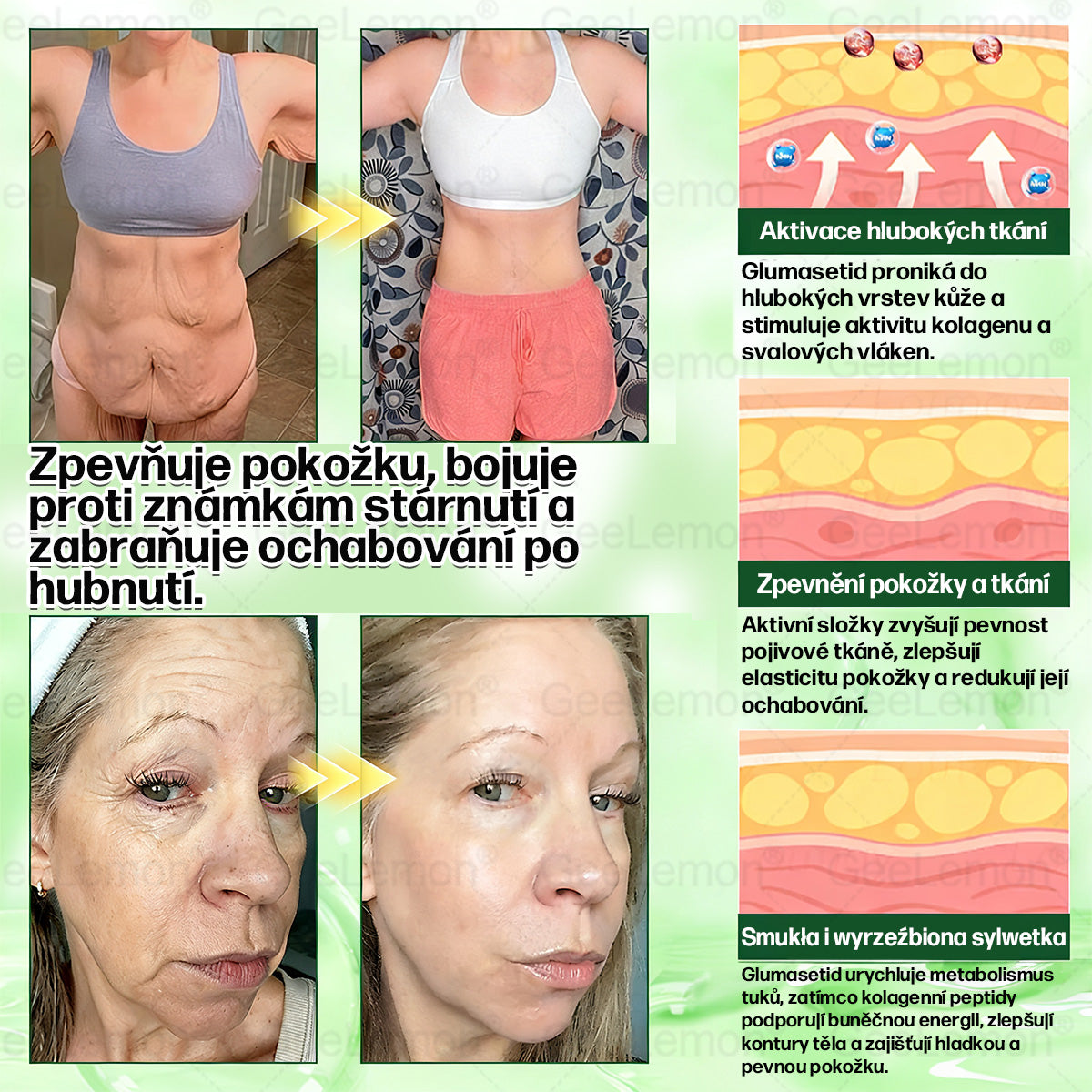 💥Doporučeno Fakultní nemocnicí Motol · Oficiální prodejna BENU | 🎁 𝐆𝐞𝑒𝑙𝑒𝐦𝐨𝐧® Glum𝐚𝐬𝐞tide 8 v 1 – Zeštíhlující nano mikrojihlový náplast 🇨🇿 Jen 1× denně ✅ Viditelné změny za 7 dní – na obezitu, kardiovaskulární zdraví, diabetes a kloubní problémy