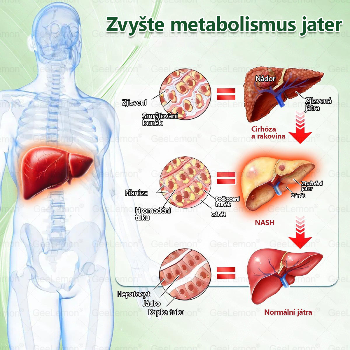 💥Doporučeno Fakultní nemocnicí Motol · Oficiální prodejna BENU | 🎁 𝐆𝐞𝑒𝑙𝑒𝐦𝐨𝐧® Glum𝐚𝐬𝐞tide 8 v 1 – Zeštíhlující nano mikrojihlový náplast 🇨🇿 Jen 1× denně ✅ Viditelné změny za 7 dní – na obezitu, kardiovaskulární zdraví, diabetes a kloubní problémy