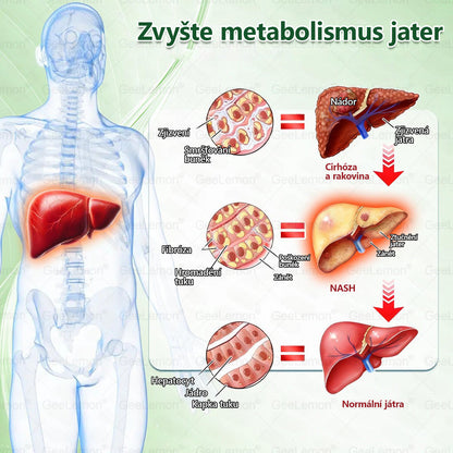 💥Doporučeno Fakultní nemocnicí Motol · Oficiální prodejna BENU | 🎁 𝐆𝐞𝑒𝑙𝑒𝐦𝐨𝐧® Glum𝐚𝐬𝐞tide 8 v 1 – Zeštíhlující nano mikrojihlový náplast 🇨🇿 Jen 1× denně ✅ Viditelné změny za 7 dní – na obezitu, kardiovaskulární zdraví, diabetes a kloubní problémy