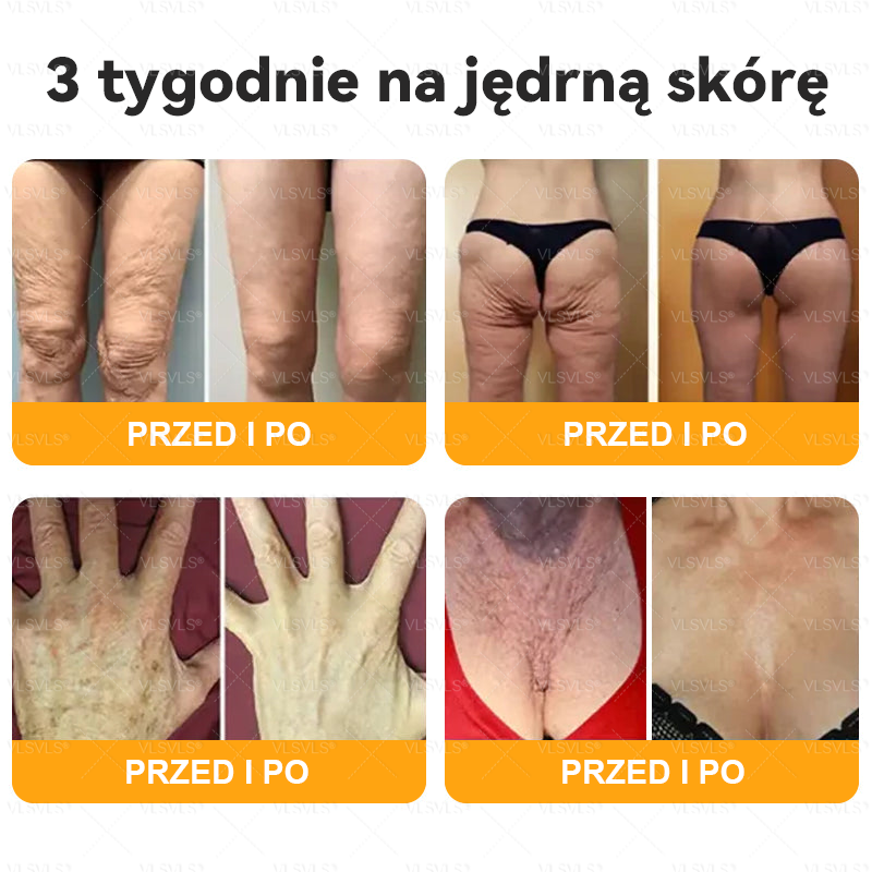 Wykonane i wysłane z Polski 🌟 𝑽𝑳𝑺𝑽𝑳𝑺® Krem z Jadem Pszczoły Kompleksowy Ostatni Dzień 80% ZNIŻKI (Opadająca Skóra, Drobne Zmarszczki, Utrata Jędrności, Płaskie Piersi, Opadające Biodra i Więcej)