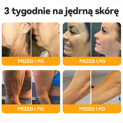 Wykonane i wysłane z Polski 🌟 𝑽𝑳𝑺𝑽𝑳𝑺® Krem z Jadem Pszczoły Kompleksowy Ostatni Dzień 80% ZNIŻKI (Opadająca Skóra, Drobne Zmarszczki, Utrata Jędrności, Płaskie Piersi, Opadające Biodra i Więcej)