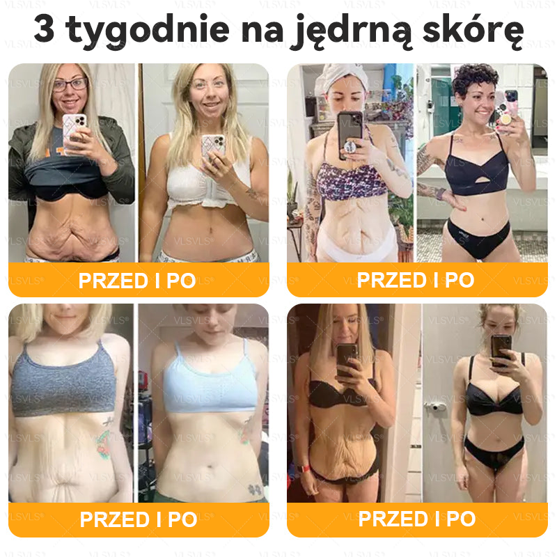 Wykonane i wysłane z Polski 🌟 𝑽𝑳𝑺𝑽𝑳𝑺® Krem z Jadem Pszczoły Kompleksowy Ostatni Dzień 80% ZNIŻKI (Opadająca Skóra, Drobne Zmarszczki, Utrata Jędrności, Płaskie Piersi, Opadające Biodra i Więcej)