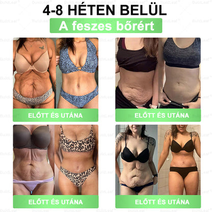 𝑩𝒖𝒊𝒍𝒅𝑳𝒆𝒂𝒇® 𝑮𝑳𝑷-1 6 𝒂𝒛 1-𝒃𝒆𝒏 𝒆𝒈é𝒔𝒛𝒔é𝒈ü𝒈𝒚𝒊 𝒐𝒍𝒅𝒂𝒕 𝒔𝒛á𝒋𝒐𝒏 á𝒕 𝒔𝒛𝒆𝒅𝒉𝒆𝒕ő 𝒇𝒐𝒍𝒚𝒂𝒅é𝒌 ✅ 𝑬𝒍𝒉í𝒛á𝒔, 𝒔𝒛í𝒗- é𝒔 é𝒓𝒓𝒆𝒏𝒅𝒔𝒛𝒆𝒓𝒊 𝒆𝒈é𝒔𝒛𝒔é𝒈, 𝒄𝒖𝒌𝒐𝒓𝒃𝒆𝒕𝒆𝒈𝒔é𝒈, 𝒂𝒍𝒗á𝒔𝒊 𝒂𝒑𝒏𝒐𝒆, 𝒃é𝒍𝒓𝒆𝒏𝒅𝒔𝒛𝒆𝒓𝒊 𝒆𝒈é𝒔𝒛𝒔é𝒈, í𝒛ü𝒍𝒆𝒕𝒊 𝒑𝒓𝒐𝒃𝒍é𝒎á𝒌 é𝒔 𝒆𝒈𝒚𝒆𝒃𝒆𝒌 𝒆𝒔𝒆𝒕é𝒏