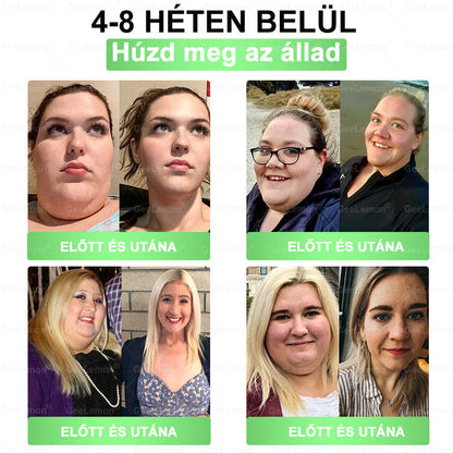 🌿Ajánlott a Semmelweis Kórház által · 👩‍⚕️BENU hivatalos üzlet| 🎁 𝐆𝐞𝑒𝐿𝑒𝐦𝐨𝐧® Glumasetide 8 az 1-ben Karcsú és Egészséges Nano Mikrotűs Tapasz 🇭🇺